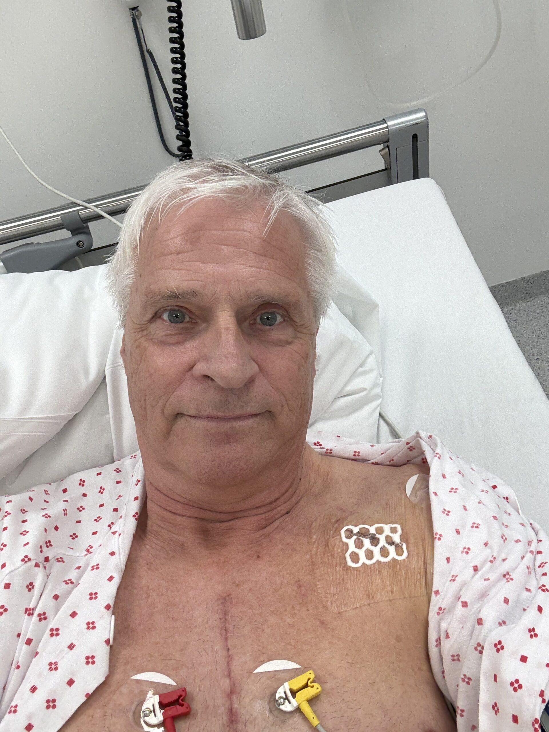 Olav Nys&aelig;ter fikk operert inn en pacemaker p&aring; AHUS Nordbyhagen.